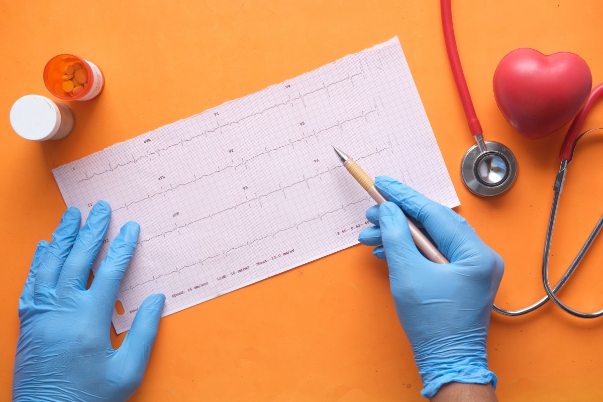 Кардиолог Погосова рассказала какие анализы необходимо сдать для прогноза болезней сердца