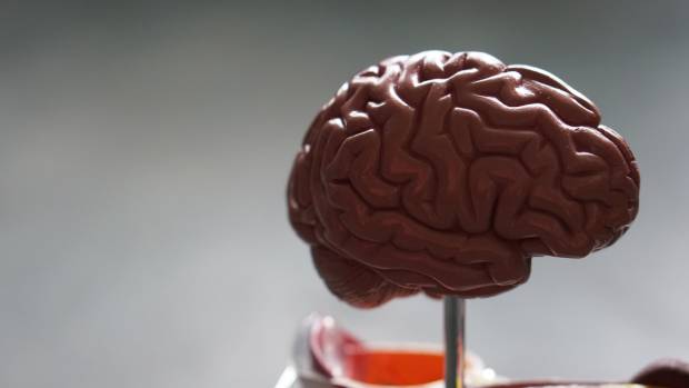 Онколог Серяков назвал возможные симптомы опухоли мозга